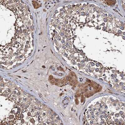 Immunohistochemistry-Paraffin: WWC3 Antibody [NBP1-90755]