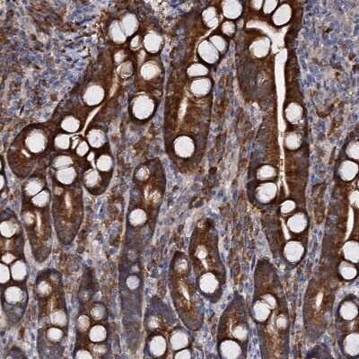 Immunohistochemistry-Paraffin: WWC3 Antibody [NBP1-90755]