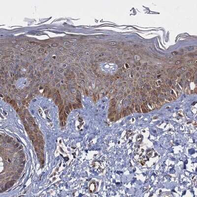 Immunohistochemistry-Paraffin: WWC3 Antibody [NBP1-90755]