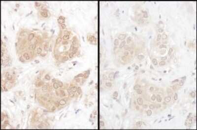 Immunohistochemistry: WWOX Antibody [NBP2-32121]