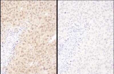Immunohistochemistry: WWOX Antibody [NBP2-32121]