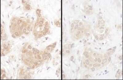 Immunohistochemistry: WWOX Antibody [NBP2-32122]