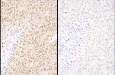 Immunohistochemistry: WWOX Antibody [NBP2-32122]
