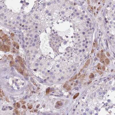 Immunohistochemistry: WWOX Antibody [NBP2-47579]