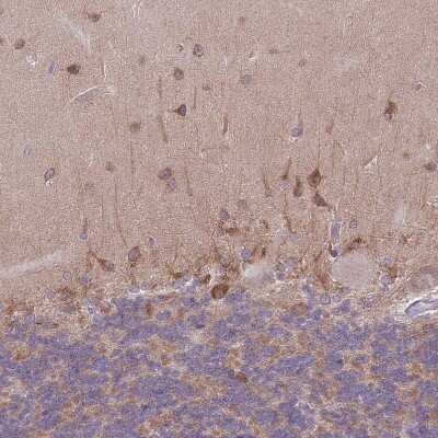 Immunohistochemistry-Paraffin: WWOX Antibody [NBP2-47579]