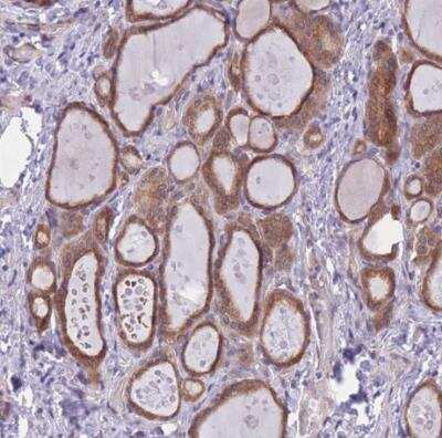 Immunohistochemistry-Paraffin: WWOX Antibody [NBP2-47579]
