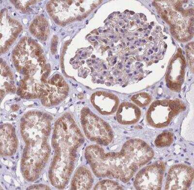 Immunohistochemistry-Paraffin: WWOX Antibody [NBP2-47579]