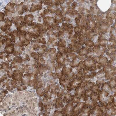 Immunohistochemistry-Paraffin: WWP1 Antibody [NBP1-89179]