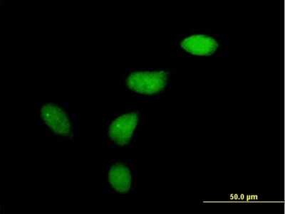 Immunocytochemistry/ Immunofluorescence: Wee1 Antibody [H00007465-B01P]