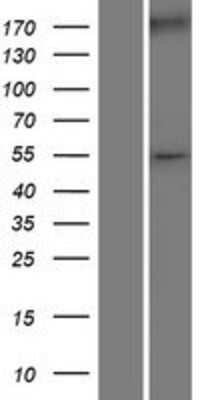 Western Blot: WT1 Overexpression Lysate [NBP2-11141]