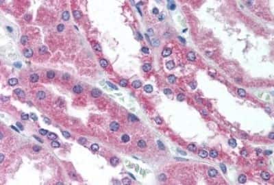 Immunohistochemistry-Paraffin: Wnt-1 Antibody [NBP3-14519]
