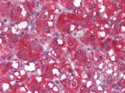 Immunohistochemistry-Paraffin: Wnt-1 Antibody (10C8) - BSA Free [NBP1-51575]