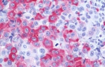 Immunohistochemistry-Paraffin: Wnt-10a Antibody [NBP3-14379]