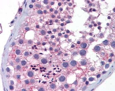 Immunohistochemistry-Paraffin: Wnt-10a Antibody [NBP1-69116]