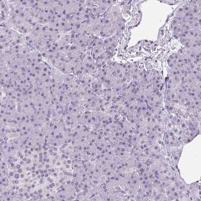 Immunohistochemistry-Paraffin: Wnt-10b Antibody [NBP2-49165]