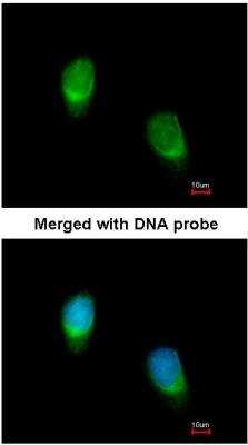 Immunocytochemistry/ Immunofluorescence: Wnt-11 Antibody [NBP1-31406]
