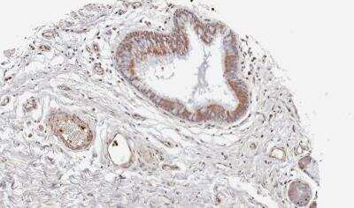 Immunohistochemistry-Paraffin: Wnt-11 Antibody [NBP1-31406]