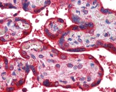 Immunohistochemistry-Paraffin: Wnt-3a Antibody [NBP1-74183]