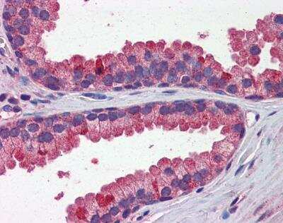 Immunohistochemistry-Paraffin: Wnt-3a Antibody [NBP1-79724]