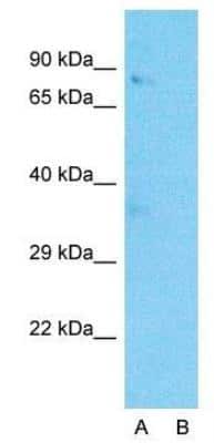 Western Blot: Wnt-3a Antibody [NBP1-74183]