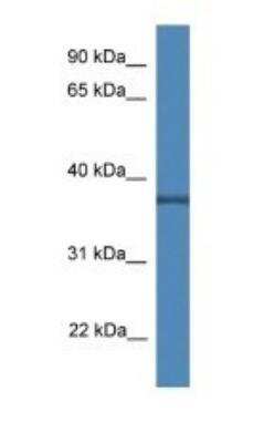 Western Blot: Wnt-3a Antibody [NBP1-74183]