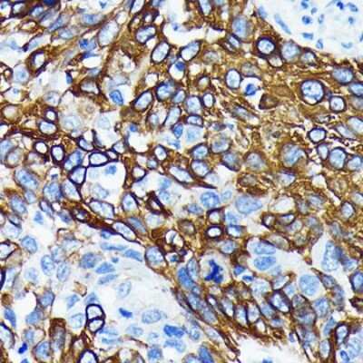 Immunohistochemistry-Paraffin: Wnt-5a Antibody (3P2E8) [NBP3-15684]