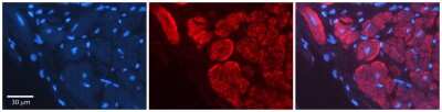Immunohistochemistry: Wnt-5a Antibody [NBP1-60032]