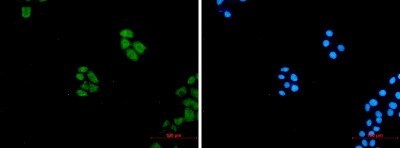 Immunocytochemistry/ Immunofluorescence: Wnt-5a Antibody (S08-4A3) [NBP3-20061]