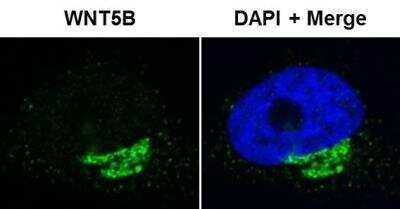 Immunocytochemistry/ Immunofluorescence: Wnt-5b Antibody [H00081029-D01P]