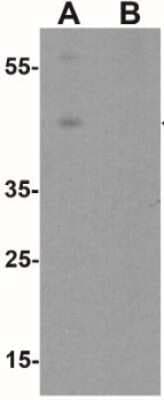 Western Blot: Wnt-5b AntibodyBSA Free [NBP2-41306]