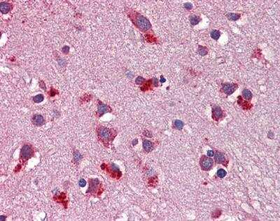 Immunohistochemistry-Paraffin: Wnt-7b Antibody [NBP1-59564]