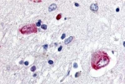 Immunohistochemistry: Wnt-8a Antibody [NBP3-14523]