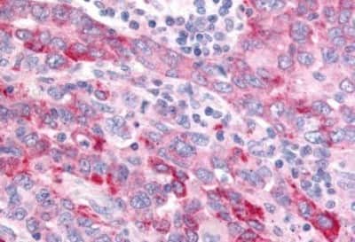 Immunohistochemistry-Paraffin: Wnt-8a Antibody [NBP3-14523]