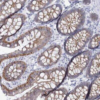 Immunohistochemistry-Paraffin: Wnt-8b Antibody [NBP1-86285]