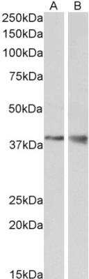 Western Blot: Wnt-9b Antibody [NBP1-51961]