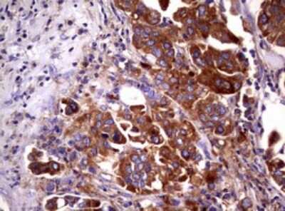 Immunohistochemistry: Wnt3 Antibody (OTI1G7) [NBP2-46367]