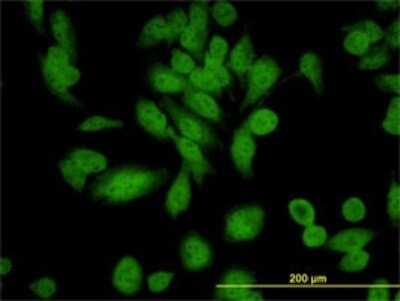 Immunocytochemistry/ Immunofluorescence: XAB1 Antibody (3E1) [H00011321-M01]