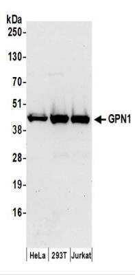 Western Blot: XAB1 Antibody [NBP2-37686]