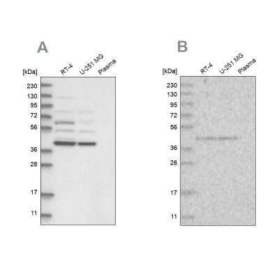 Western Blot: XAB1 Antibody [NBP2-38332]