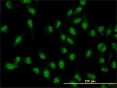 Immunocytochemistry/ Immunofluorescence: XAB2 Antibody (1D1-1A9) [H00056949-M01]