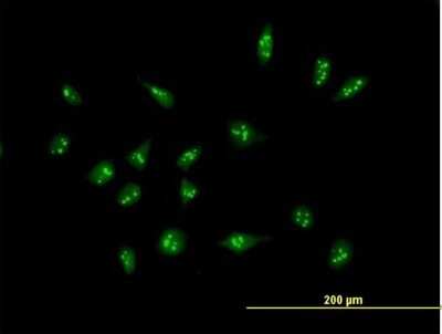 Immunocytochemistry/ Immunofluorescence: XAGE2 Antibody [H00009502-B01P]