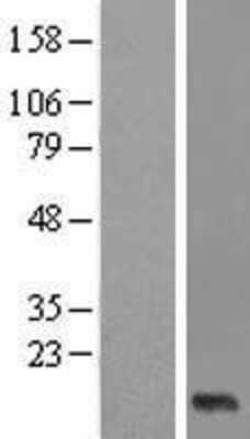 Western Blot: XAGE2B Overexpression Lysate [NBL1-12627]