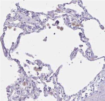 Immunohistochemistry-Paraffin: XCL1/Lymphotactin Antibody [NBP2-46844]