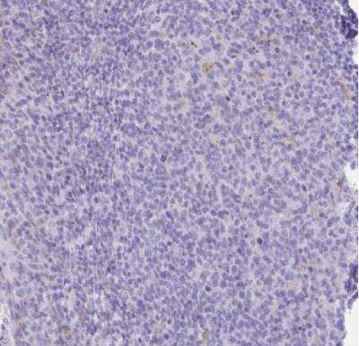 Immunohistochemistry-Paraffin: XCL1/Lymphotactin Antibody [NBP2-46844]