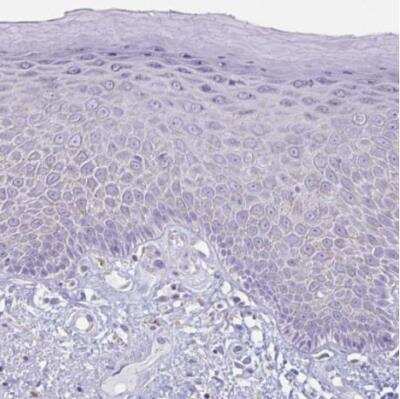 Immunohistochemistry-Paraffin: XCL1/Lymphotactin Antibody [NBP2-46844]