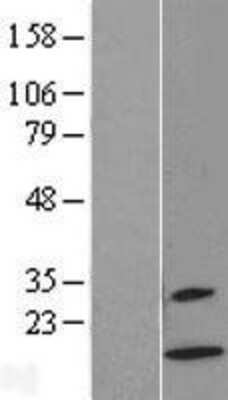 Western Blot: XCL2 Overexpression Lysate [NBL1-17902]