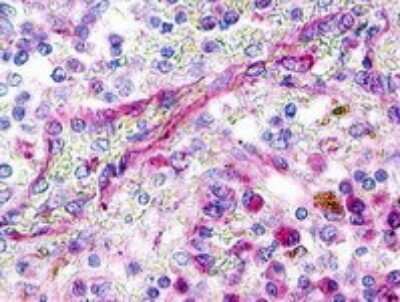 Immunohistochemistry-Paraffin: XCR1/CCXCR1 Antibody - BSA Free [NLS156]