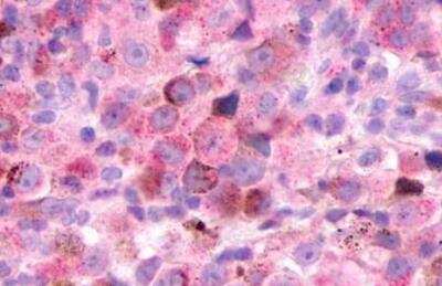 Immunohistochemistry-Paraffin: XCR1/CCXCR1 Antibody - BSA Free [NLS156]