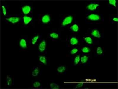 Immunocytochemistry/ Immunofluorescence: XE7 Antibody (2G8) [H00008227-M02]