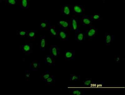 Immunocytochemistry/ Immunofluorescence: XE7 Antibody [H00008227-B01P]